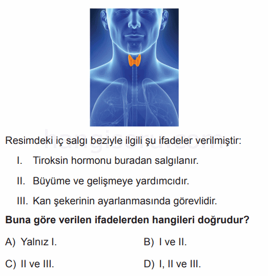 Soru 10