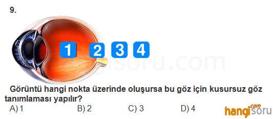 Soru 9