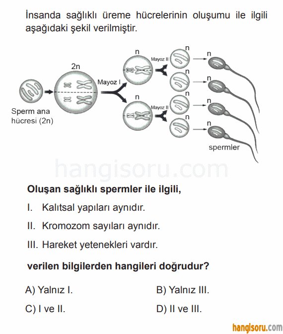 Soru 10